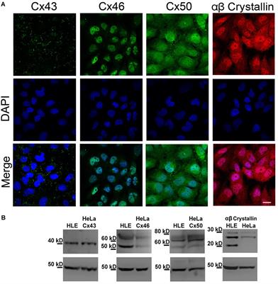 Contribution of Connexin Hemichannels to the Decreases in Cell Viability Induced by Linoleic Acid in the Human Lens Epithelial Cells (HLE-B3)